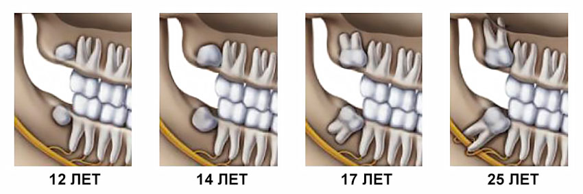 Как происходит смена зубов?